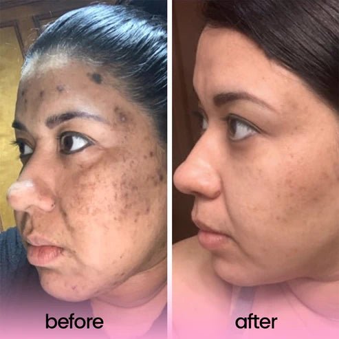 Brightening Turmeric & Kojic Acid Face Pads